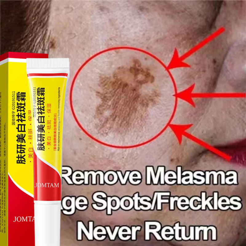 Krim Pemutih Flek Hitam Krim P - Skincare Niacinamide ulasan dan harga